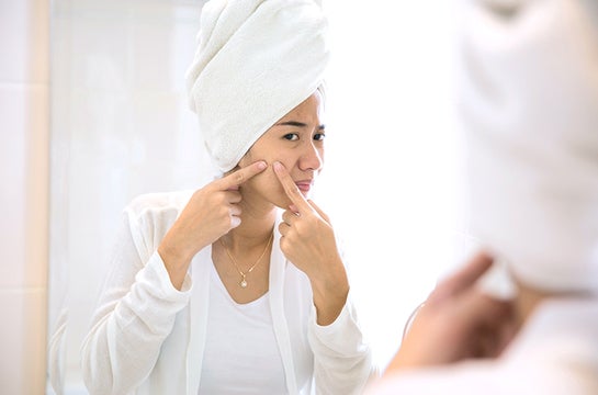 10 Facts You Need to Know About Acne